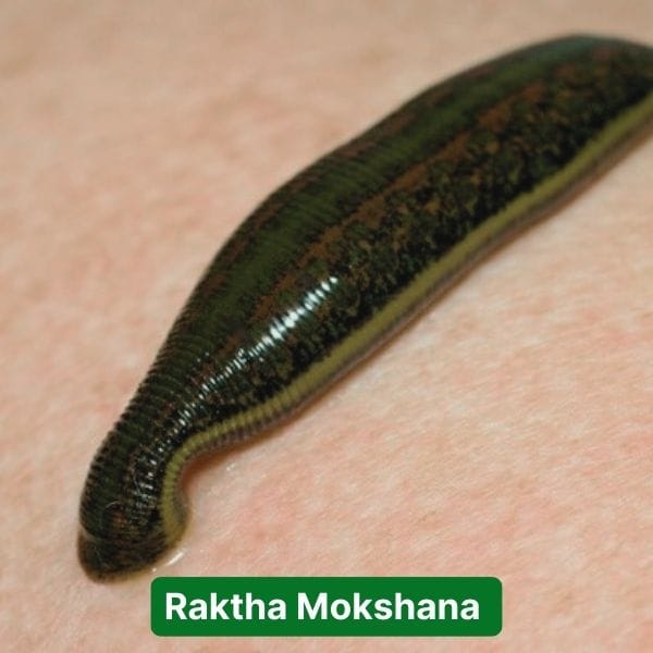 Raktha Mokshana
